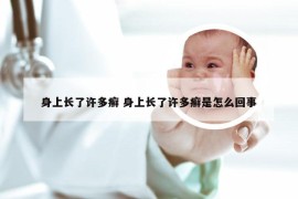 身上长了许多癣 身上长了许多癣是怎么回事