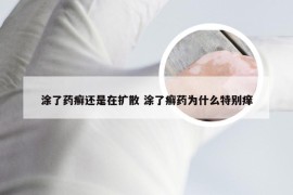 涂了药癣还是在扩散 涂了癣药为什么特别痒