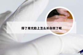 得了用亢脸上怎么长白斑了呢