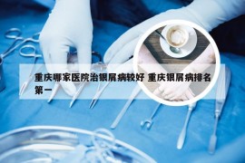 重庆哪家医院治银屑病较好 重庆银屑病排名第一