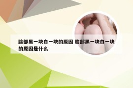 脸部黑一块白一块的原因 脸部黑一块白一块的原因是什么