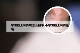 学生脸上有白块怎么回事 小学生脸上有白色块