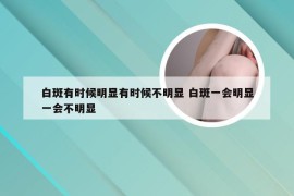 白斑有时候明显有时候不明显 白斑一会明显一会不明显