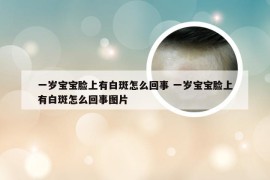 一岁宝宝脸上有白斑怎么回事 一岁宝宝脸上有白斑怎么回事图片