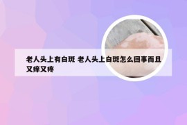 老人头上有白斑 老人头上白斑怎么回事而且又痒又疼