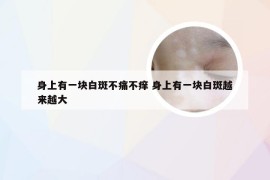 身上有一块白斑不痛不痒 身上有一块白斑越来越大