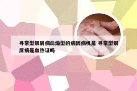 寻常型银屑病血燥型的病因病机是 寻常型银屑病是血热证吗