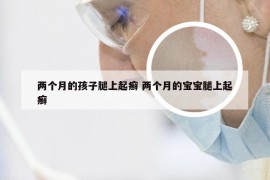 两个月的孩子腿上起癣 两个月的宝宝腿上起癣