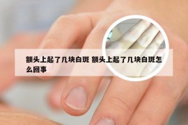 额头上起了几块白斑 额头上起了几块白斑怎么回事