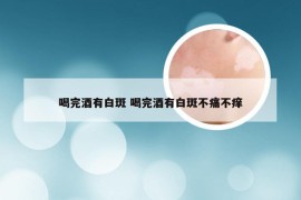 喝完酒有白斑 喝完酒有白斑不痛不痒