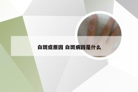 白斑症原因 白斑病因是什么