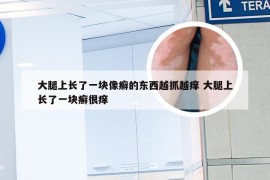 大腿上长了一块像癣的东西越抓越痒 大腿上长了一块癣很痒