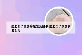 脸上长了很多癣是怎么回事 脸上长了很多藓怎么治