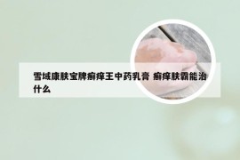 雪域康肤宝牌癣痒王中药乳膏 癣痒肤霸能治什么