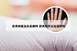 舒夫林能治头皮癣吗 舒夫林可以治湿疹吗