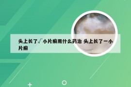 头上长了√小片癣用什么药治 头上长了一小片癣