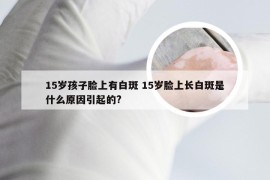 15岁孩子脸上有白斑 15岁脸上长白斑是什么原因引起的?