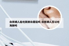 白斑病人能吃新鲜白蘑菇吗 白斑病人可以吃海鲜吗