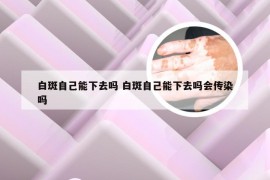 白斑自己能下去吗 白斑自己能下去吗会传染吗