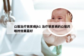 口服治疗银屑病jk1 治疗银屑病的口服药哪种效果最好