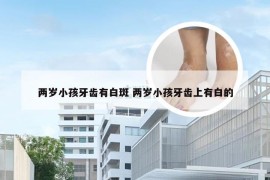 两岁小孩牙齿有白斑 两岁小孩牙齿上有白的