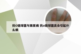 抗O链球菌与银屑病 抗o链球菌高会引起什么病