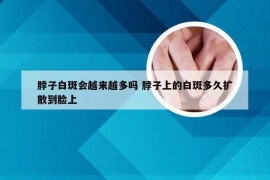 脖子白斑会越来越多吗 脖子上的白斑多久扩散到脸上