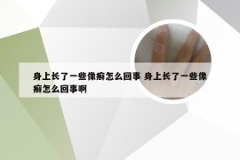 身上长了一些像癣怎么回事 身上长了一些像癣怎么回事啊