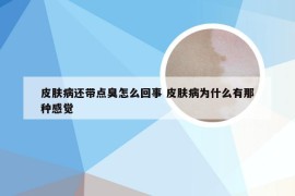 皮肤病还带点臭怎么回事 皮肤病为什么有那种感觉