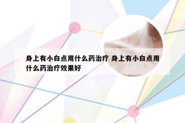 身上有小白点用什么药治疗 身上有小白点用什么药治疗效果好