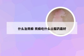 什么治阴癣 阴癣吃什么口服药最好