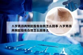 八岁男孩两侧屁股有白斑怎么回事 八岁男孩两侧屁股有白斑怎么回事儿