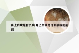 身上白块是什么病 身上白块是什么病症的前兆