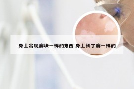 身上出现癣块一样的东西 身上长了癣一样的