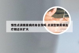 慢性点滴银屑病终身会发吗 点滴型银屑病治疗期还长扩大