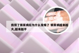 我得了银屑病后为什么变瘦了 银屑病越来越大,越来越平