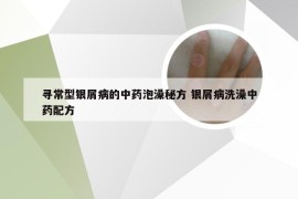 寻常型银屑病的中药泡澡秘方 银屑病洗澡中药配方