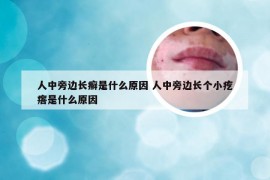 人中旁边长癣是什么原因 人中旁边长个小疙瘩是什么原因