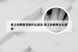 身上长癣有没有什么说法 身上长癣有什么症状