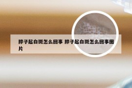 脖子起白斑怎么回事 脖子起白斑怎么回事图片