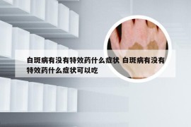 白斑病有没有特效药什么症状 白斑病有没有特效药什么症状可以吃