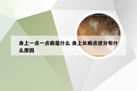 身上一点一点癣是什么 身上长癣点状分布什么原因