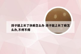 孩子腿上长了快癣怎么办 孩子腿上长了癣怎么办,不疼不痒