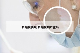 白颠疯表现 白颠疯病严重吗