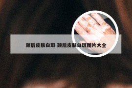 颈后皮肤白斑 颈后皮肤白斑图片大全