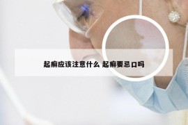 起癣应该注意什么 起癣要忌口吗