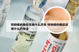 特别痒的癣应该用什么药膏 特别痒的癣应该用什么药膏涂