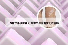 白斑三年没有变化 白斑三年没有变化严重吗