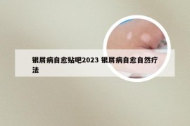 银屑病自愈贴吧2023 银屑病自愈自然疗法