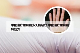 中医治疗银屑病多久能起效 中医治疗银屑病特效方